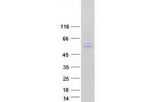 Image no. 1 for Tubulointerstitial Nephritis Antigen-Like 1 (TINAGL1) protein (Myc-DYKDDDDK Tag) (ABIN2733771)