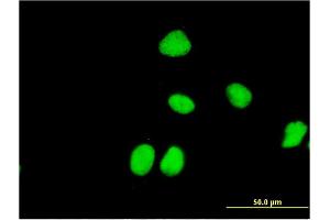 Image no. 3 for anti-Zinc Finger and SCAN Domain Containing 31 (ZSCAN31) (AA 1-209) antibody (ABIN528601)