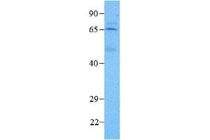 Image no. 3 for anti-Meis Homeobox 2 (MEIS2) (N-Term) antibody (ABIN2775951)