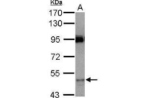 Image no. 1 for anti-Cytochrome P450, Family 3, Subfamily A, Polypeptide 7 (CYP3A7) (Center) antibody (ABIN2855738)