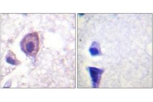 Image no. 2 for anti-CD4 (CD4) (AA 401-450) antibody (ABIN1532559)