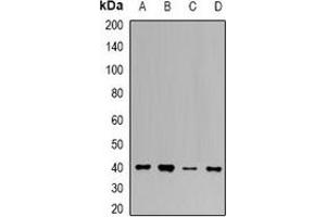 Image no. 2 for anti-Uroporphyrinogen Decarboxylase (UROD) antibody (ABIN2967137)