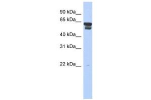 Image no. 1 for anti-Bleomycin Hydrolase (BLMH) (Middle Region) antibody (ABIN631453)
