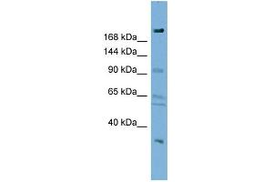 Image no. 1 for anti-DIP2 Disco-Interacting Protein 2 Homolog A (DIP2A) (N-Term) antibody (ABIN2782383)