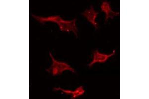 Image no. 1 for anti-Stathmin 1 (STMN1) (pSer25) antibody (ABIN6255120)