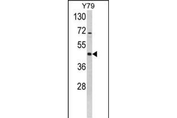 MEK2 antibody  (AA 200-229)