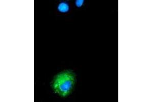 Image no. 6 for anti-Sequestosome 1 (SQSTM1) antibody (ABIN1499988)