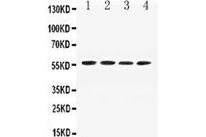 Image no. 2 for anti-Angiotensinogen (serpin Peptidase Inhibitor, Clade A, Member 8) (AGT) (AA 25-115) antibody (ABIN5518727)