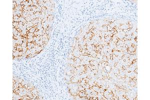 Image no. 1 for anti-Carbonic Anhydrase XIV (CA14) (AA 1-290) antibody (ABIN1996857)