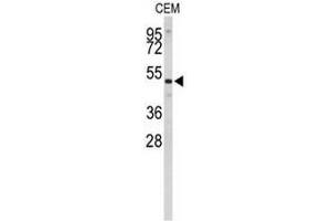 Image no. 2 for anti-Carnosine Dipeptidase 1 (Metallopeptidase M20 Family) (CNDP1) (AA 422-451), (C-Term) antibody (ABIN951583)
