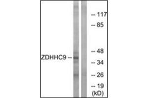 Image no. 2 for anti-Zinc Finger, DHHC-Type Containing 9 (ZDHHC9) (C-Term) antibody (ABIN1449763)