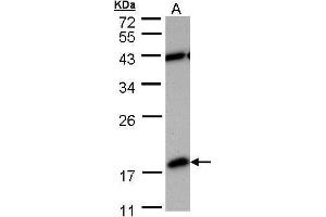 Image no. 2 for anti-phosphodiesterase 6D, CGMP-Specific, Rod, delta (PDE6D) (full length) antibody (ABIN2856660)
