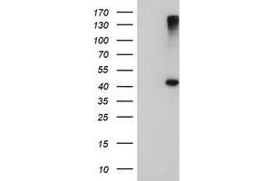 Image no. 6 for anti-1-Acylglycerol-3-Phosphate O-Acyltransferase 5 (Lysophosphatidic Acid Acyltransferase, Epsilon) (AGPAT5) antibody (ABIN1496497)