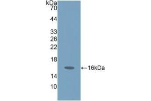ProGRP anticorps  (AA 54-148)