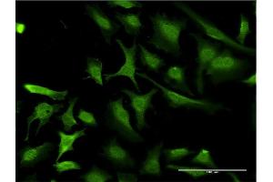 Image no. 2 for anti-Ring Finger Protein 1 (RING1) (AA 81-170) antibody (ABIN519796)