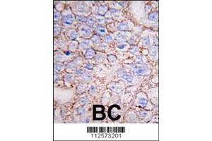 Image no. 3 for anti-Mitogen-Activated Protein Kinase 15 (MAPK15) (AA 32-61), (N-Term) antibody (ABIN391796)