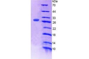Image no. 1 for Mediator Complex Subunit 1 (MED1) (AA 1-212) protein (His tag) (ABIN6239062)