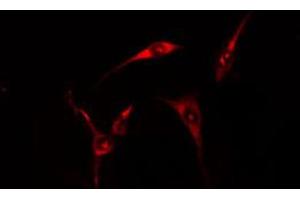 Image no. 2 for anti-Cell Death-Inducing DFFA-Like Effector B (CIDEB) antibody (ABIN6258021)