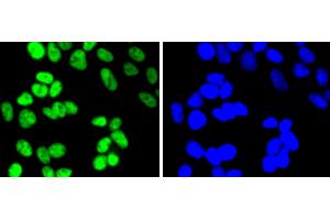 Image no. 1 for anti-Histone Deacetylase 2 (HDAC2) antibody (ABIN5557480)