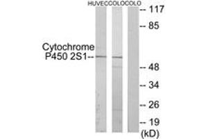 Image no. 1 for anti-Cytochrome P450, Family 2, Subfamily S, Polypeptide 1 (CYP2S1) (AA 181-230) antibody (ABIN1534391)