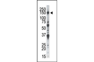 anti-NIMA-Related Kinase 1 (NEK1) (AA 1165-1196), (C-Term) antibody