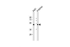 Image no. 1 for anti-Zinc Metalloproteinase, Ste24 (Zmpste24) (AA 400-430) antibody (ABIN5533179)