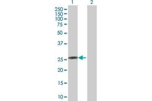 Western Blot analysis of KCNIP4 expression in transfected 293T cell line by KCNIP4 MaxPab polyclonal antibody.