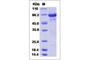 Image no. 1 for Peptidyl Arginine Deiminase, Type IV (PADI4) (AA 1-663) protein (His tag) (ABIN2693535)