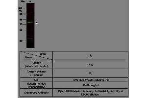 Image no. 3 for anti-Nephroblastoma Overexpressed (NOV) (AA 1-357) antibody (ABIN1996223)