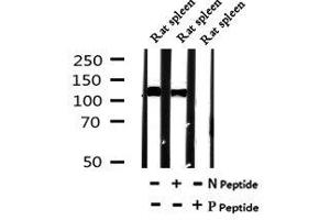 Image no. 4 for anti-Unc-51 Like Kinase 1 (ULK1) (pSer131) antibody (ABIN6269709)