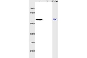 Image no. 5 for anti-Solute Carrier Family 5 (Sodium/iodide Cotransporter), Member 5 (SLC5A5) (AA 525-618) antibody (ABIN668751)