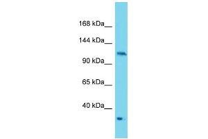 Image no. 1 for anti-Protein Kinase N2 (PKN2) (C-Term) antibody (ABIN2788942)