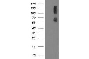 Image no. 1 for anti-Protein Phosphatase, Mg2+/Mn2+ Dependent, 1G (PPM1G) antibody (ABIN1500378)