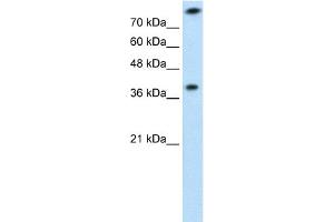 Image no. 3 for anti-Thiosulfate Sulfurtransferase (Rhodanese) (TST) (Middle Region) antibody (ABIN2777154)
