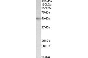 anti-Solute Carrier Family 46 (Folate Transporter), Member 1 (SLC46A1) (AA 233-247) antibody