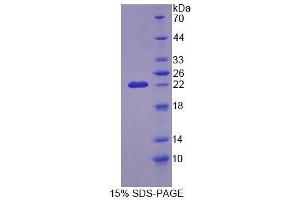 Image no. 1 for Cyclin-Dependent Kinase Inhibitor 2D (p19, Inhibits CDK4) (CDKN2D) (AA 1-166) protein (ABIN6239471)
