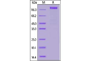 Image no. 2 for SARS-CoV-2 Spike S1 protein (Fc Tag) (ABIN6952624)