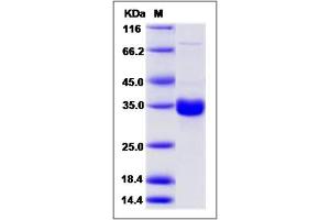 Image no. 1 for Collectin Sub-Family Member 11 (COLEC11) (AA 1-272) protein (His tag) (ABIN2007499)