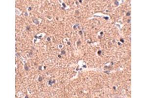 Image no. 3 for anti-UDP-N-Acetyl-alpha-D-Galactosamine:polypeptide N-Acetylgalactosaminyltransferase 10 (GalNAc-T10) (GALNT10) (N-Term) antibody (ABIN6657271)