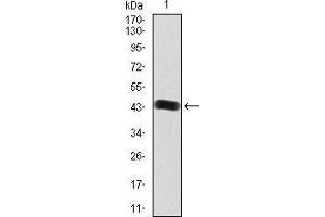 Image no. 2 for anti-Fibroblast Growth Factor Receptor 3 (FGFR3) (AA 529-694) antibody (ABIN5542299)