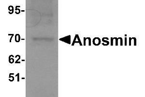 Western blot analysis of Anosmin in MCF7 cell lysate with Anosmin antibody at 1 µg/mL.