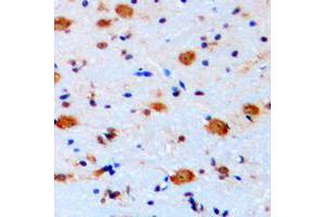 Immunohistochemical analysis of ARHGAP22 staining in human brain formalin fixed paraffin embedded tissue section.