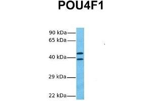 Image no. 2 for anti-POU Domain, Class 4, Transcription Factor 1 (POU4F1) (C-Term) antibody (ABIN2780756)