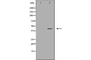 Image no. 1 for anti-Major Histocompatibility Complex, Class I, A (HLA-A) antibody (ABIN6262283)
