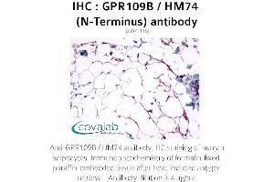 Image no. 2 for anti-Hydroxycarboxylic Acid Receptor 3 (HCAR3) (Extracellular Domain), (N-Term) antibody (ABIN1734901)