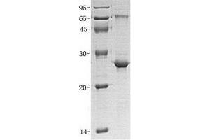 Image no. 1 for Protein Phosphatase, Mg2+/Mn2+ Dependent, 1G (PPM1G) (Transcript Variant 1) protein (His tag) (ABIN2729811)