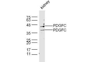Image no. 1 for anti-Platelet-Derived Growth Factor C (PDGFC) (AA 201-300) antibody (ABIN714566)