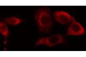 Image no. 2 for anti-Cytochrome P450, Family 39, Subfamily A, Polypeptide 1 (CYP39A1) antibody (ABIN6258390)