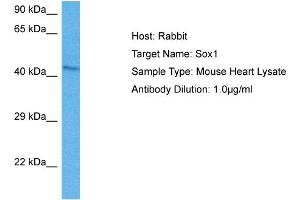 Image no. 2 for anti-SRY (Sex Determining Region Y)-Box 1 (SOX1) (Middle Region) antibody (ABIN2777427)