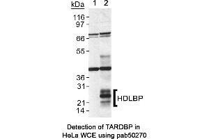 Image no. 1 for anti-High Density Lipoprotein Binding Protein (HDLBP) (AA 100-180), (Internal Region) antibody (ABIN363579)